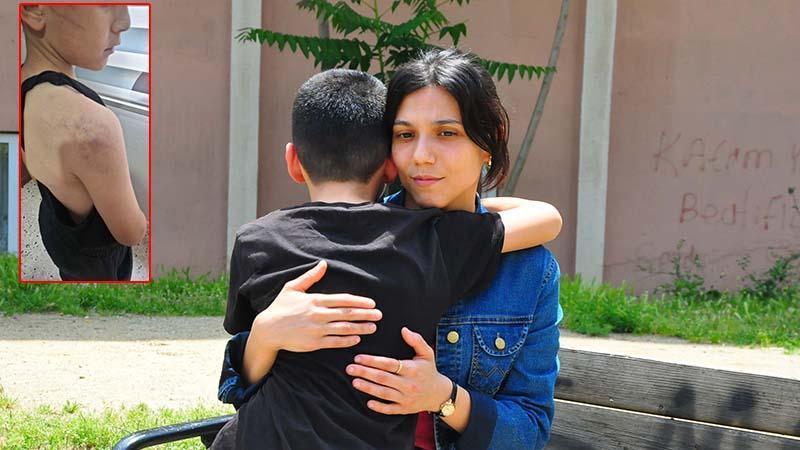 Babasının darbettiği 12 yaşındaki çocuk koruma altına alındı