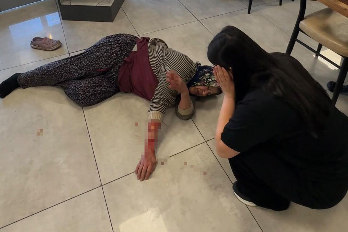 Saldırgan köpek kadının kolunu kopardı