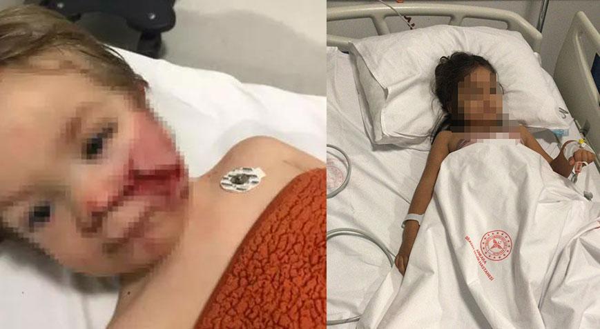 2 kardeşe saldırıp yaralayan pitbullun sahibi hakkında karar! 'Çocuğumu mahvettiler'